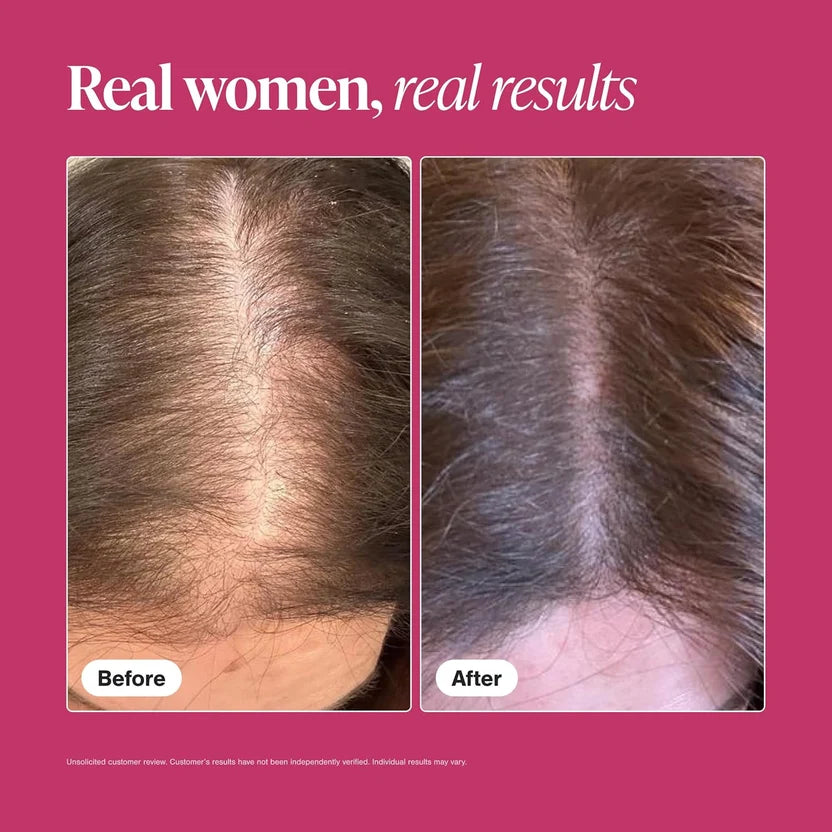 Viviscal Women’s Hair Growth 60 Tablets